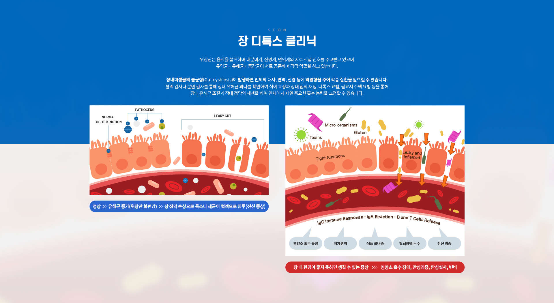 항노화/건강증진클리닉 세온내과 장디톡스클리닉 