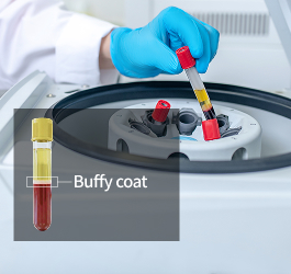 고농도 성분 추출