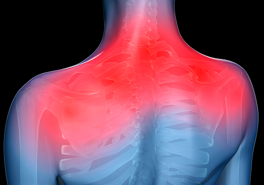 유기적 접근(목 - 날개 - 어깨)